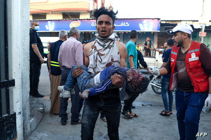 EDITORS NOTE: Graphic content / A badly wounded child is carried into a hospital following an Israeli strike in Rafah in the…